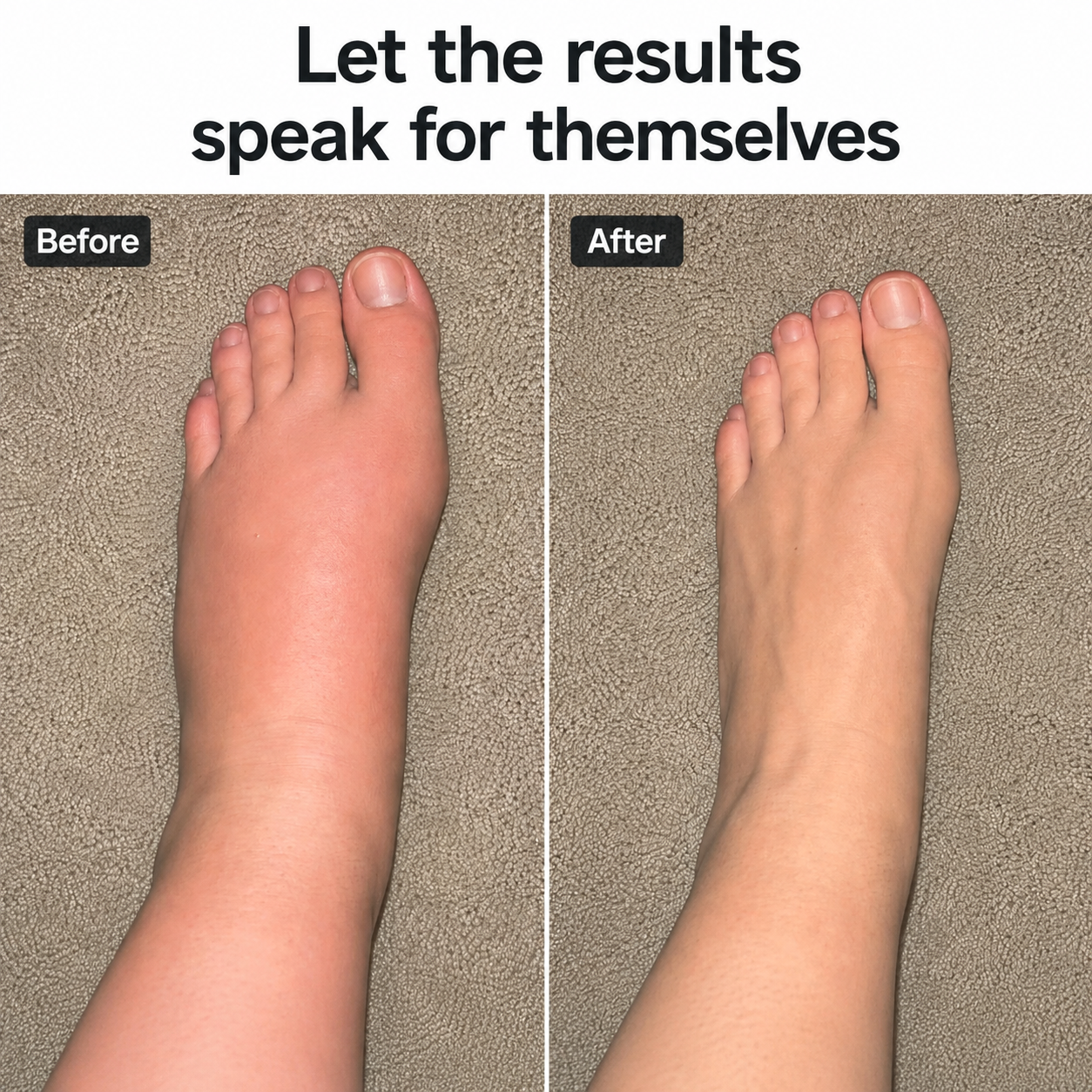 Ankle Compression Socks for Swelling & Aching Feet